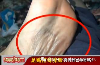 大约两三分钟后就明显感受到脚心开始出汗,经过了8个多小时之后,第二