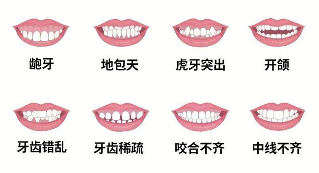 牙列不齐公益筛查名额又新增正畸大咖双十一亲诊丨专题