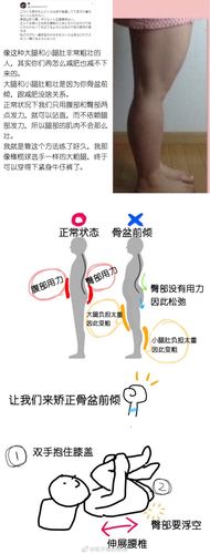盆骨前倾 小腹下垂 圆肩驼背