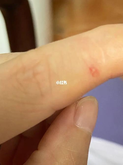 被仓鼠咬了一口_仓鼠_碘伏_肥皂_宠物_宠物其他