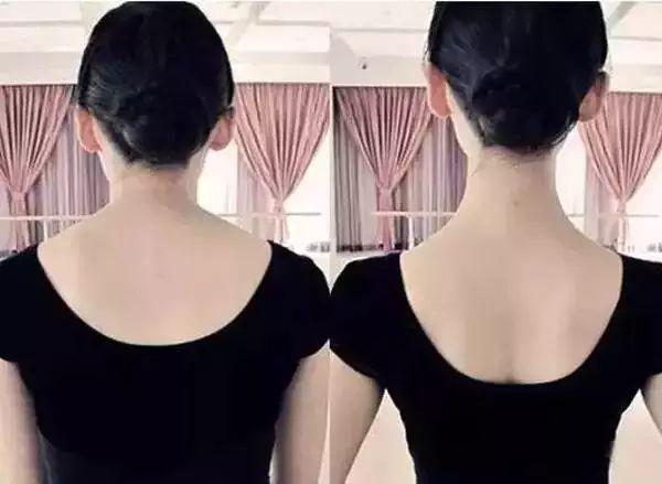 陈妍希张子枫显矮显胖没气质,还不都是因为脖子短!