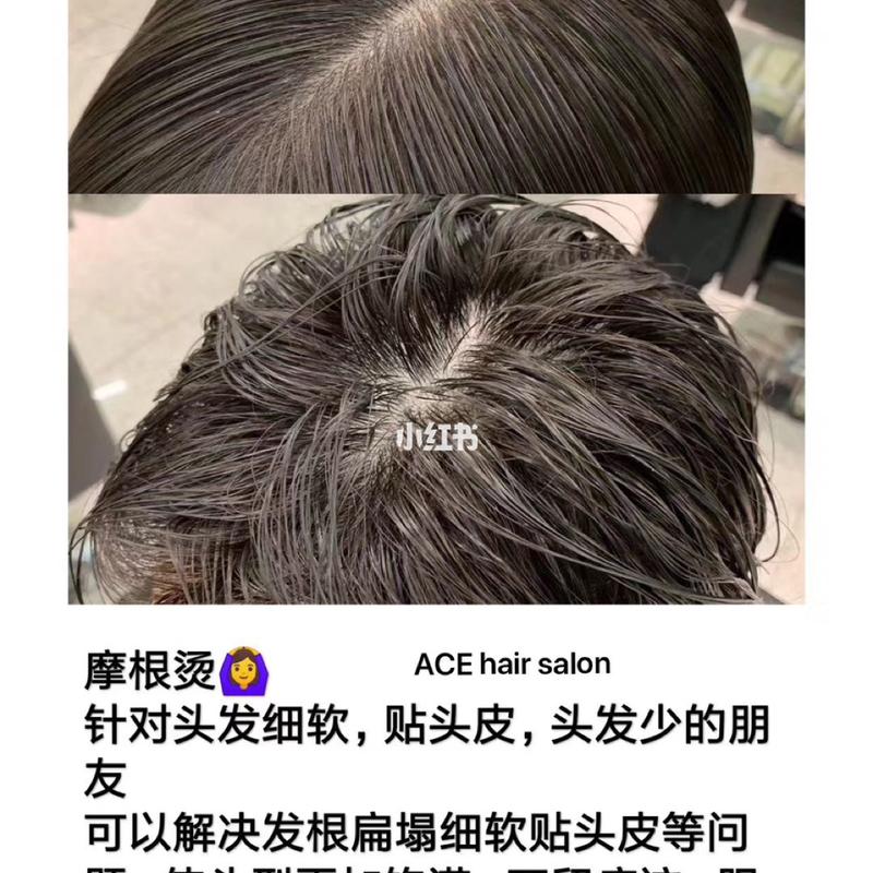 头发细软 贴头皮的救星来啦