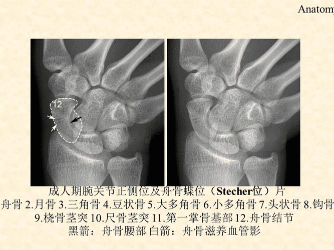 腕关节x线解剖