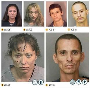 吸毒者溃烂恐怖面容真相/组图(1)_全媒体_光明网