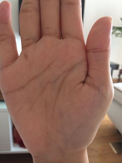 女,右手,想问问中间的智慧线为什么断开了.谢谢.