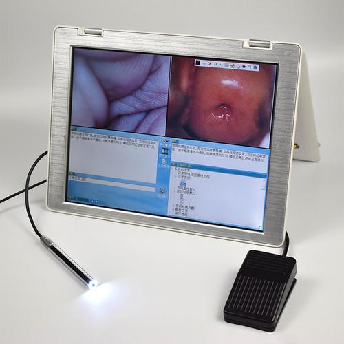 电子阴道镜宫颈检查镜私密检测仪妇科检查器内窥镜阴道检测窥视镜