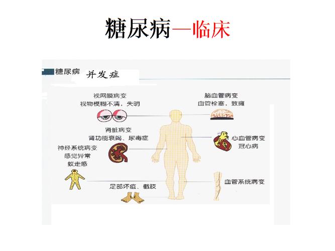 可怕的是由糖尿病相起的并发症,80% 的糖尿病患者最终死於并发症