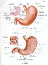 性胃炎指由化脓菌引起,以胃壁黏膜下层病变为主的急性感染性胃部疾患
