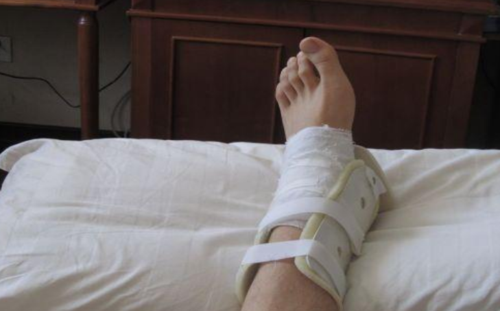 故事:老汉搭救蛤蟆,蛤蟆给他带来钱财,却将他的儿子腿