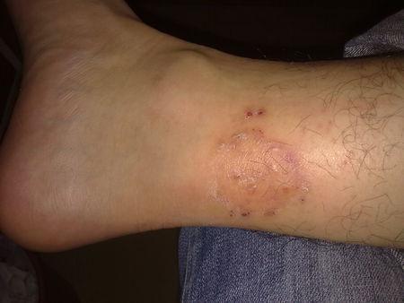 晕!艾滋病都被你说不来了!