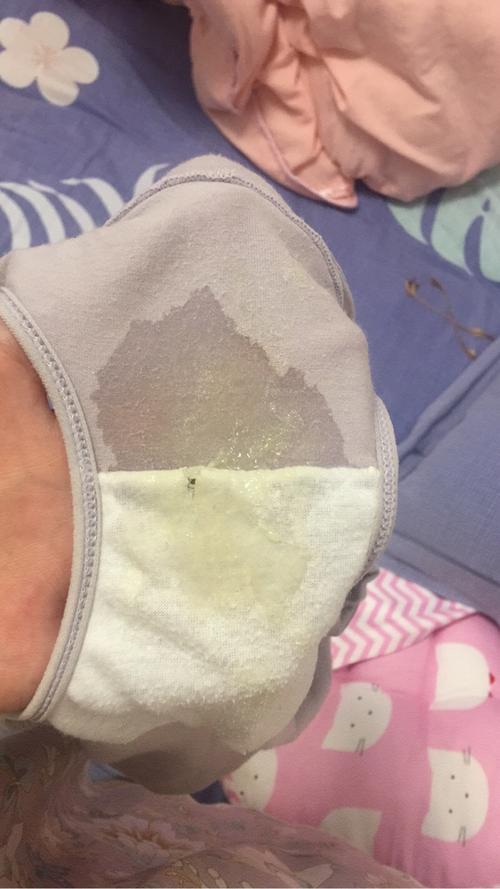 怀孕六个月了这是怎么回事,这是漏羊水还是漏尿?