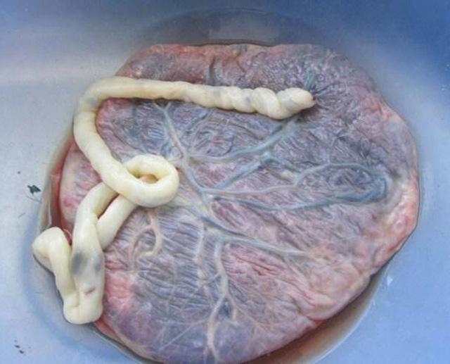 原创生完孩子后你知道胎盘去哪儿了吗它的下场很多人意想不到