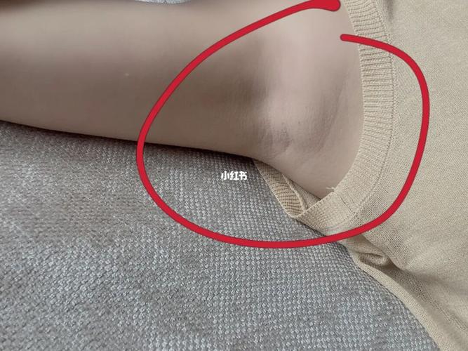 请问腋下鼓包是病吗?_医疗健康_医疗健康其他