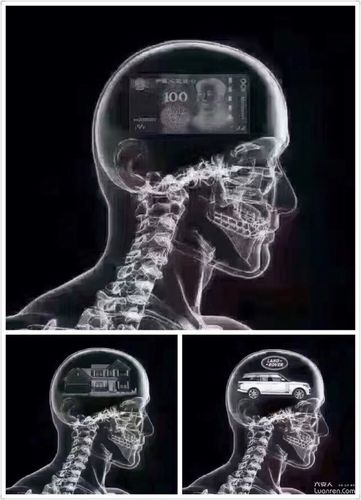 最近总是头痛,去医院做了个ct,医生说我想多了