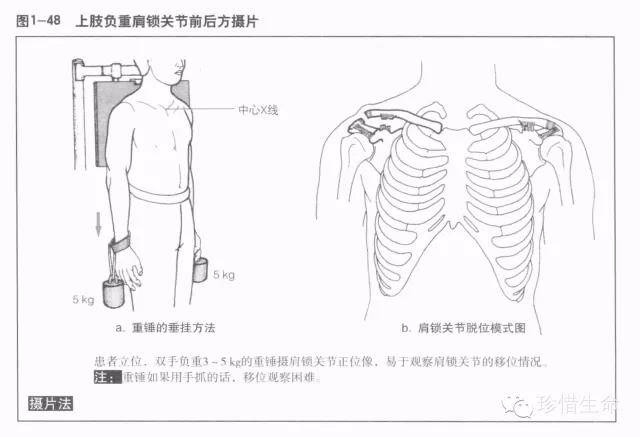 肩关节x线检查体位大全你都了解吗