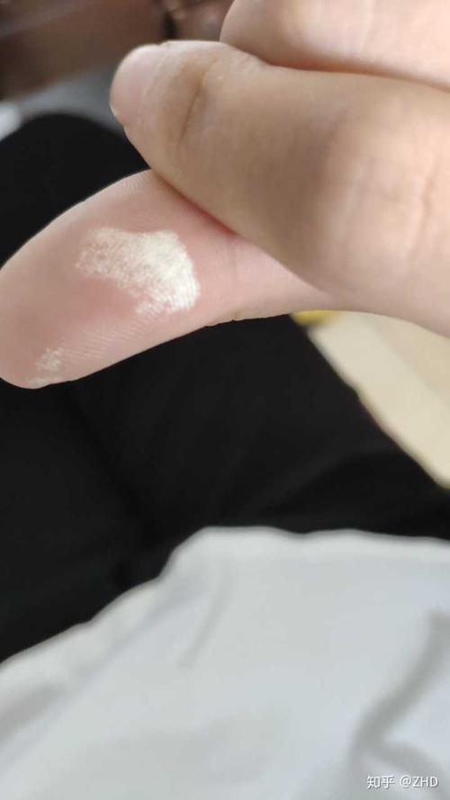 手粘上双氧水怎么处理?