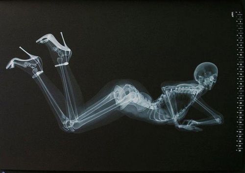 惊悚?x光版骨感美女日历