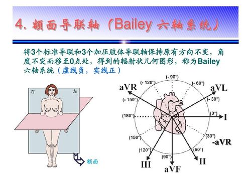 心电图导联位置女性