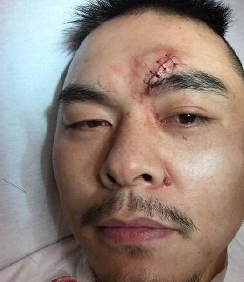 重量级拳击比赛的中国巨人拳王张志磊在与美国三流拳击手福雷斯特