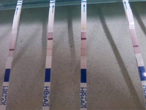 问:乙型肝炎病毒表面抗原检测试纸质控线显的淡是怎么回事?中间的两个