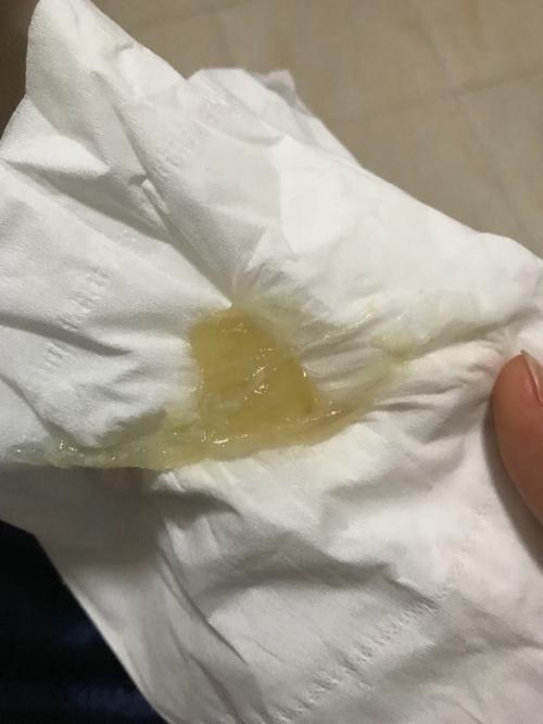 请问这样事破羊水了吗?