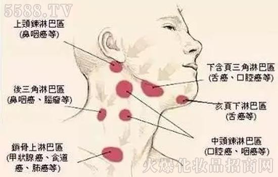 我没开玩笑,你连做淋巴保养的钱都没有,哪有钱得淋巴癌?