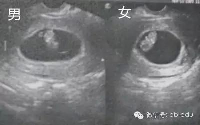 怀孕4个月照的彩超,大家能看得出是男宝吗?