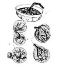 图中是不同类型的胎盘a是b是c是