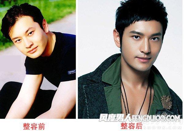 黄晓明植发是真的吗黄晓明整容前后对比图