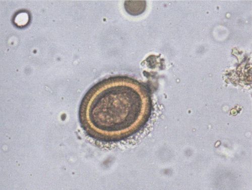 链状带绦虫虫卵