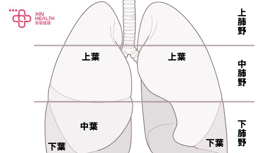 各肺野分布情况图