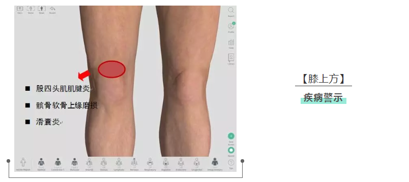 当膝盖损伤后 不同的疼痛位置警示者这些膝关节疾病的
