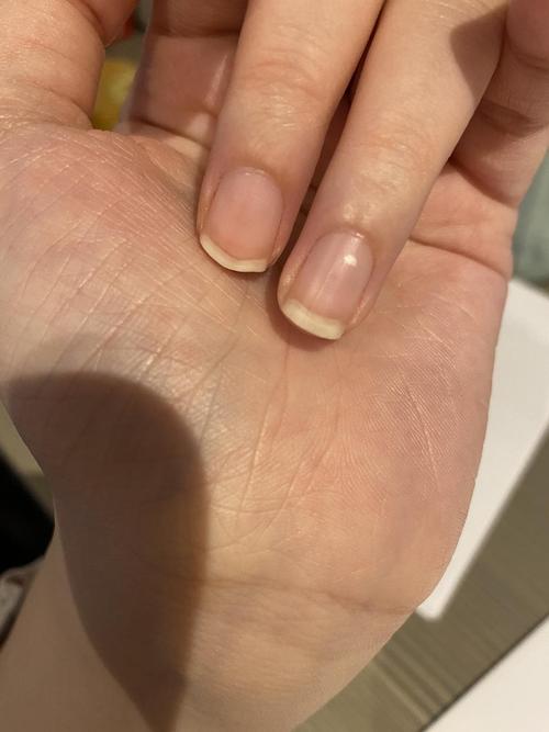 指甲前面有点钙分层的感觉