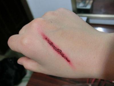 37,生活中难免会受伤,破皮流血等,破皮伤口的正确处理方法