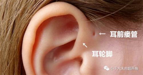 图1:"小丑鱼"的鳃在第一条白色环线处,开口于白线后缘.