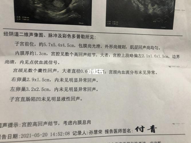 子宫内膜息肉_子宫_月经_疫情_体检_隔离_子宫内膜