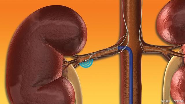 肝胆胰脾肾出问题3项检查揪出病根别乱猜测了