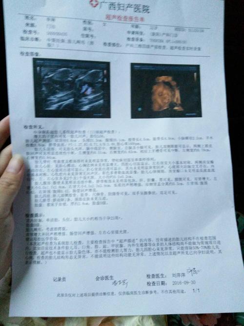 23周唇腭裂,考虑了想不要 - 2017年2月出生帮 - 妈妈帮