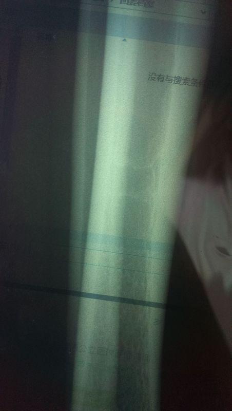 迎面骨撞伤有裂纹医生说没事却不敢吃