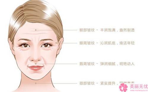 除皱纹实际效果,以致使去除皱纹实际效果