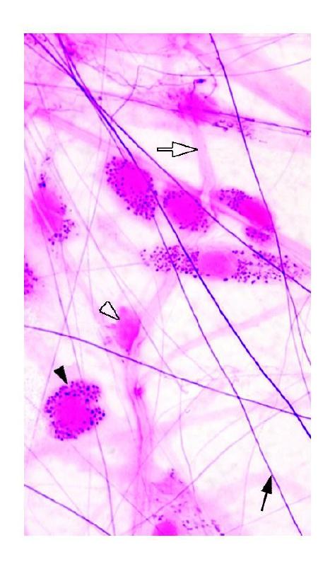 在醛复红染色时显紫色(图3-17);he染色时呈红亮色,折光性强.