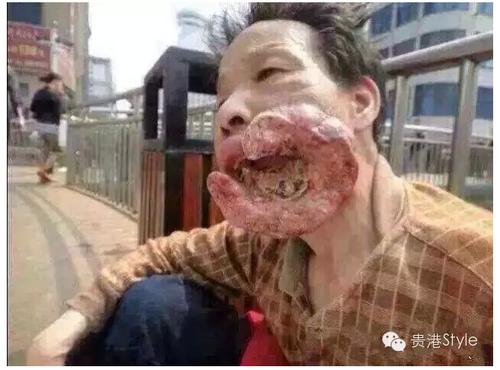 吃槟榔对人体有什么好处?