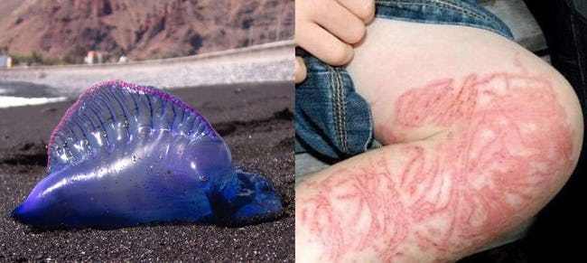 被水母刺伤的葡萄牙人,很想纹身