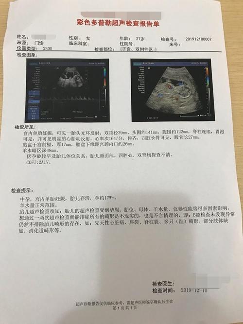 胎心率真的能看出男女?