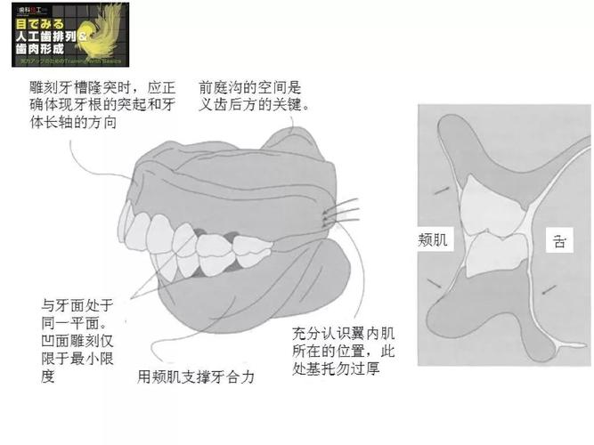 在制作光滑面时,应充分考虑舌体的感受,在上腭与下颌舌侧,做出与舌