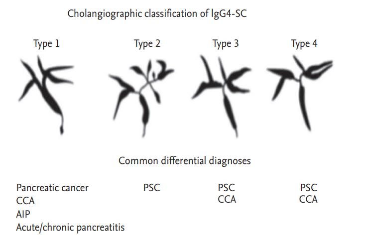 immunoglobulin g4-related sclerosing cholangitis