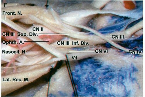 眶上裂:动眼,滑车,眼,外展神经; 眼神经:额神经,泪腺神经,鼻睫神经