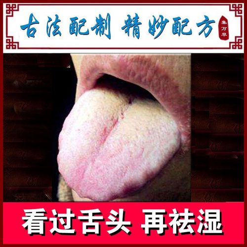 齿痕舌调理 齿印 舌苔厚黄白脾胃虚气虚口臭口苦口干