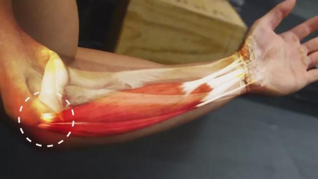 健身肘关节疼痛的3大常见原因及解决方式