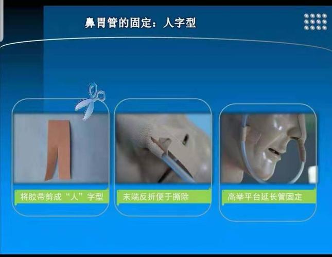 写美篇       每次鼻饲前应证实胃管在胃内且通畅,并用少量温水冲管后